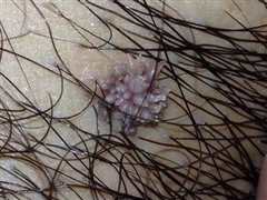 糗事集锦 第一季