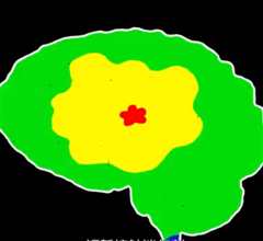 头脑解密脑内解码